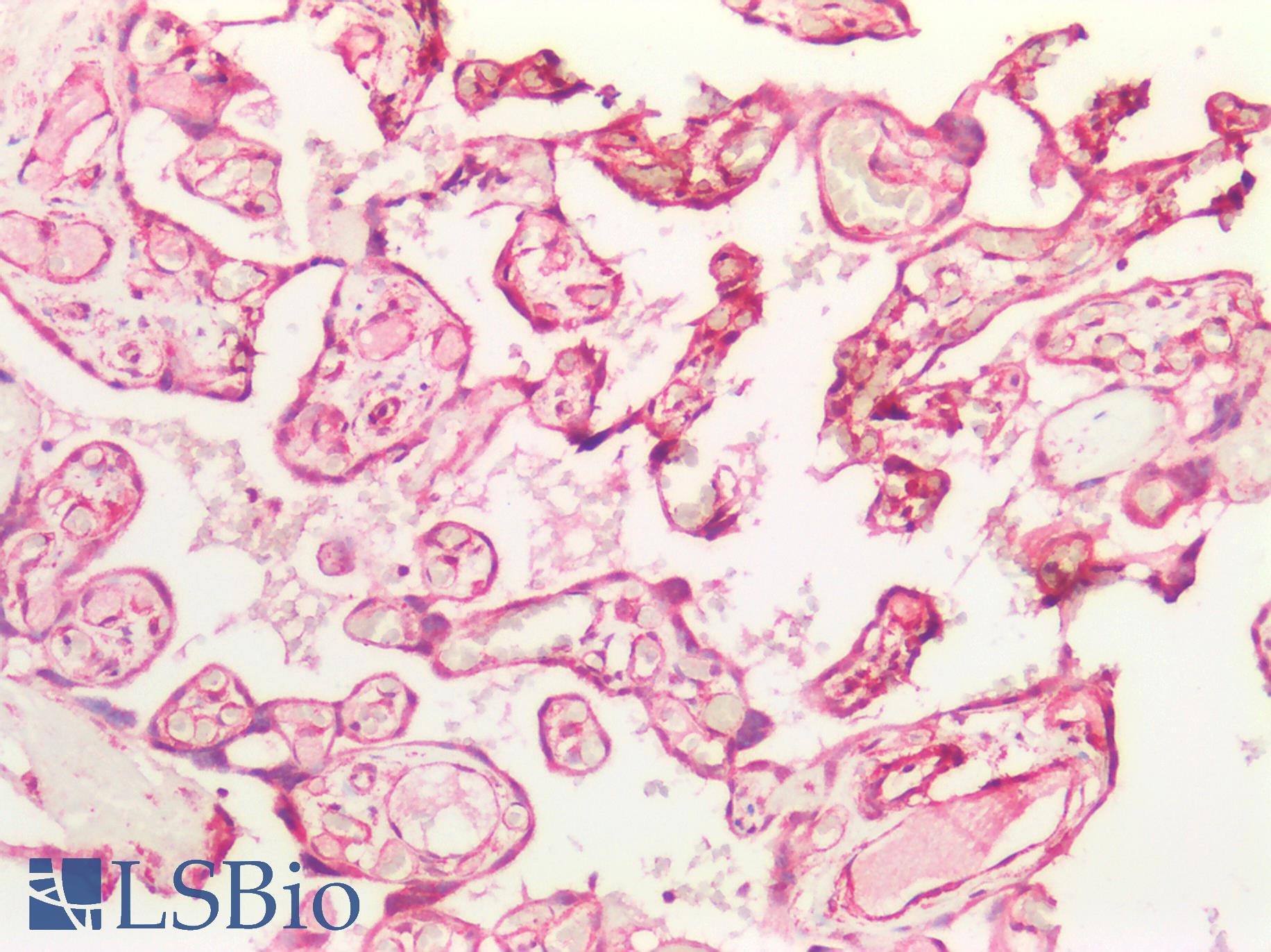 TGFBR1 / ALK5 Antibody - Human Placenta: Formalin-Fixed, Paraffin-Embedded (FFPE)
