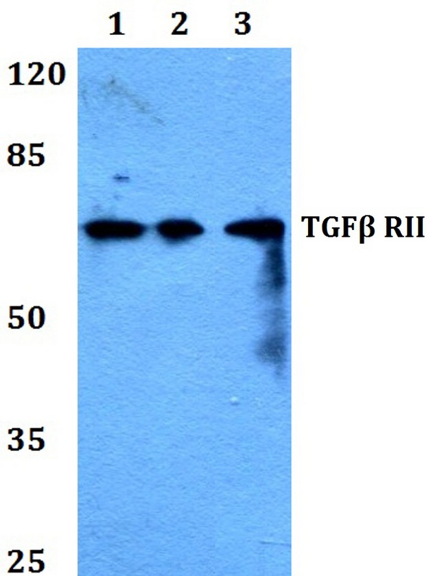 TGFBR2 Antibody - Western blot analysis of Anti-TGFBR2 Antibody at 1:500 dilution. Lane 1: HeLa whole cell lysate. Lane 2: Raw264.7 whole cell lysate. Lane 3: H9C2 whole cell lysate.