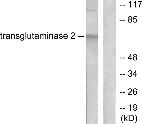 TGM2 / Transglutaminase 2 Antibody - Western blot analysis of lysates from HUVEC cells, using Transglutaminase 2 Antibody. The lane on the right is blocked with the synthesized peptide.