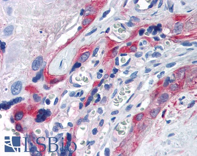TGM2 / Transglutaminase 2 Antibody - Anti-TGM2 / Transglutaminase 2 antibody IHC of human placenta. Immunohistochemistry of formalin-fixed, paraffin-embedded tissue after heat-induced antigen retrieval. Antibody concentration 5 ug/ml. This image was taken for the unmodified form of this product. Other forms have not been tested.