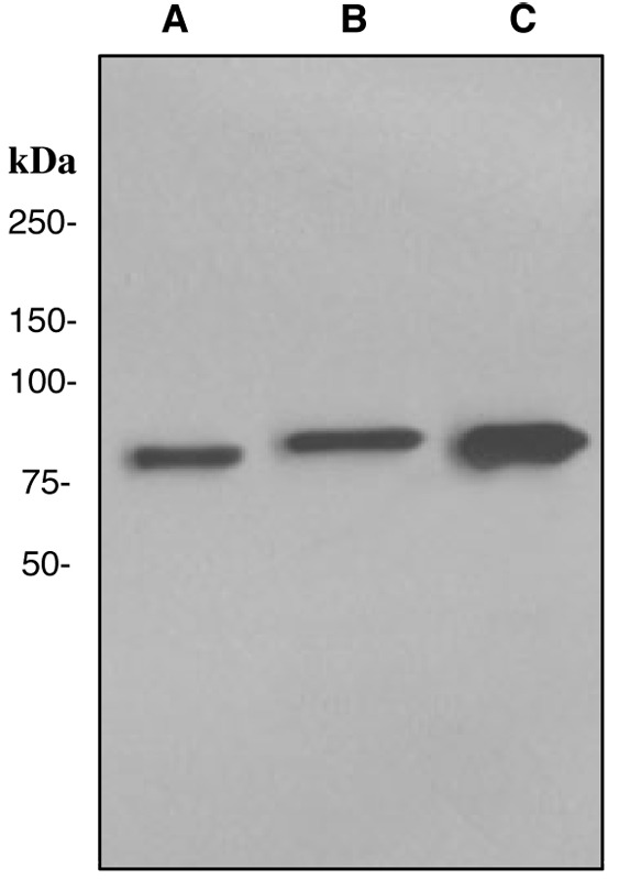TGM2 / Transglutaminase 2 Antibody - Western blot analysis on (A) U87-MG, (B) A549, and (C) HUVEC cell lysates using anti-Transglutaminase 2 antibody.
