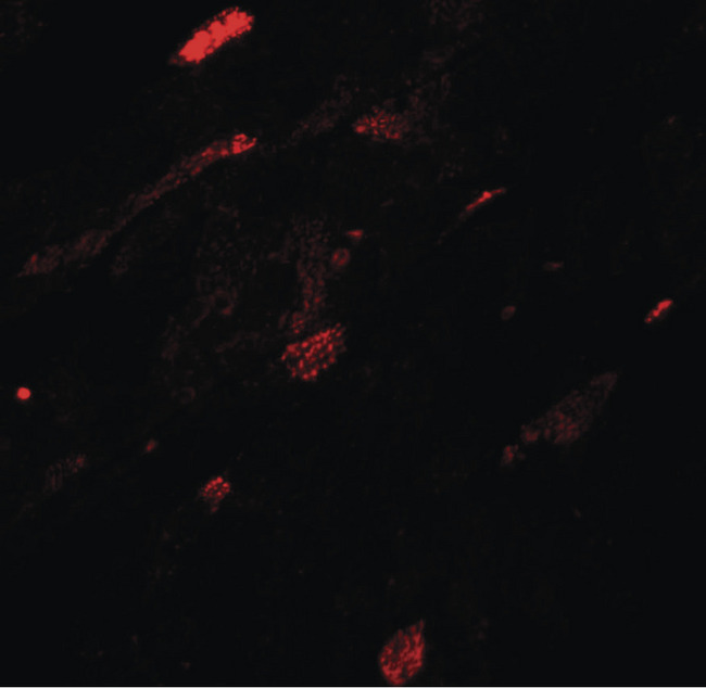 TGM5 / Transglutaminase 5 Antibody - Immunofluorescence of TGM5 in mouse heart tissue with TGM5 antibody at 20 ug/ml.