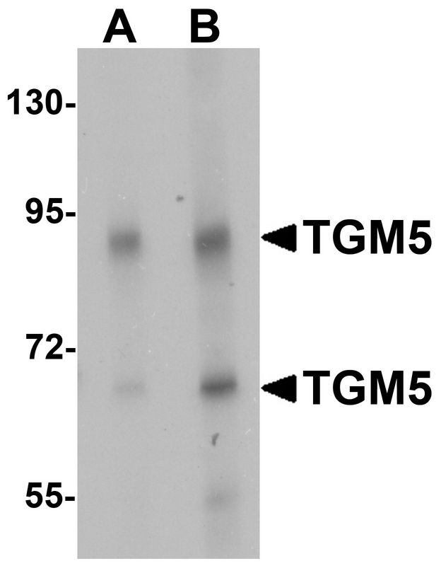 TGM5 / Transglutaminase 5 Antibody - Western blot analysis of TGM5 in rat heart tissue lysate with TGM5 antibody at (A) 1 and (B) 2 ug/ml.