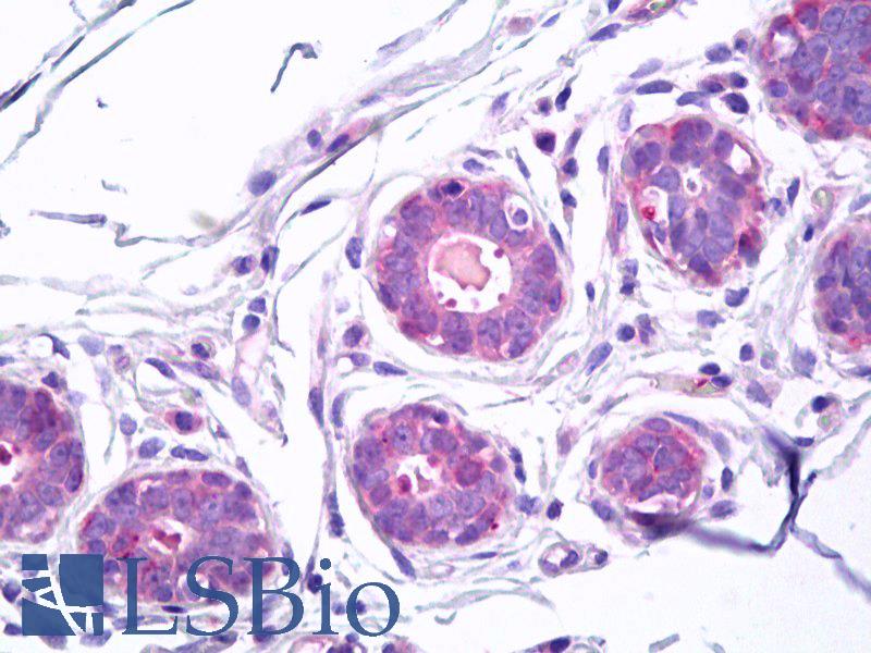 TGM5 / Transglutaminase 5 Antibody - Anti-Transglutaminase 5 antibody IHC of human breast. Immunohistochemistry of formalin-fixed, paraffin-embedded tissue after heat-induced antigen retrieval. Antibody concentration 10 ug/ml.