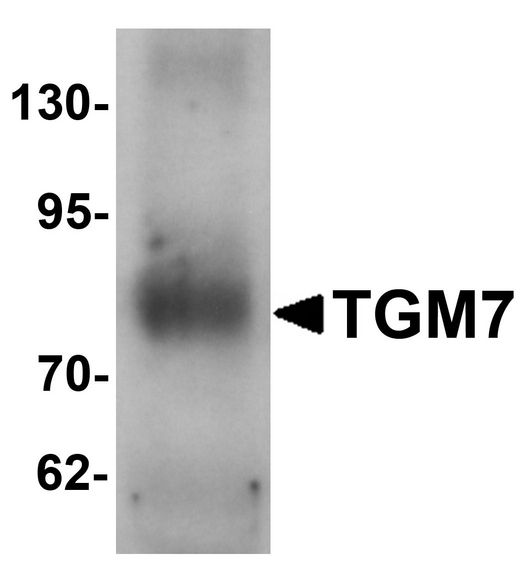 TGM7 / Transglutaminase 7 Antibody - Western blot analysis of TGM7 in human lung tissue lysate with TGM7 antibody at 1 ug/ml.