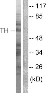 TH / Tyrosine Hydroxylase Antibody - Western blot analysis of lysates from NIH/3T3 cells, treated with Forskolin 40nM 30', using Tyrosine Hydroxylase Antibody. The lane on the right is blocked with the synthesized peptide.