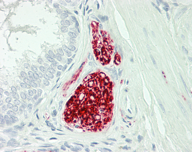 TH / Tyrosine Hydroxylase Antibody - Human Prostate, Nerve: Formalin-Fixed, Paraffin-Embedded (FFPE)