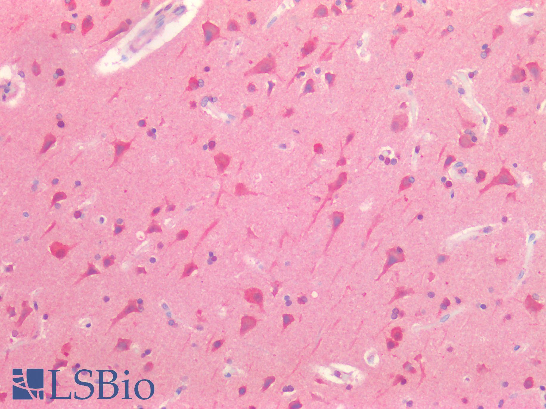TH / Tyrosine Hydroxylase Antibody - Human Brain, Cortex: Formalin-Fixed, Paraffin-Embedded (FFPE)