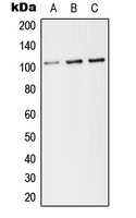 THBD / CD141 / Thrombomodulin Antibody - Western blot analysis of CD141 expression in HEK293T (A); Raw264.7 (B); PC12 (C) whole cell lysates.