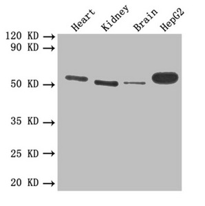 THBD / CD141 / Thrombomodulin Antibody - Western blot All Lanes: THBD antibody at 1 ug/ml Lane 1: Mouse heart tissue Lane 2: Mouse kidney tissue Lane 3: Mouse brain tissue Lane 4: HepG-2 whole cell lysate Secondary Goat polyclonal to rabbit IgG at 1/10000 dilution Predicted band size: 60 kDa Observed band size: 60 kDa