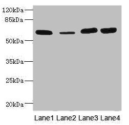 THBD / CD141 / Thrombomodulin Antibody - Western blot All Lanes: THBD antibody at 3.07ug/ml Lane 1: Rat heart tissue Lane 2: Mouse kidney tissue Lane 3: A549 whole cell lysate Lane 4: A431 whole cell lysate Secondary Goat polyclonal to rabbit IgG at 1/10000 dilution Predicted band size: 60 kDa Observed band size: 60 kDa