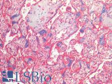 THBD / CD141 / Thrombomodulin Antibody - Human Placenta: Formalin-Fixed, Paraffin-Embedded (FFPE)