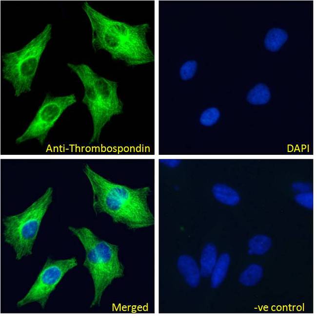 THBS1 / Thrombospondin-1 Antibody - THBS1 / Thrombospondin-1 antibody immunofluorescence analysis of paraformaldehyde fixed HeLa cells, permeabilized with 0.15% Triton. Primary incubation 1hr (10ug/ml) followed by Alexa Fluor 488 secondary antibody (4ug/ml), showing cytoplasmic staining. The nuclear stain is DAPI (blue). Negative control: Unimmunized goat IgG (10ug/ml) followed by Alexa Fluor 488 secondary antibody (2ug/ml).