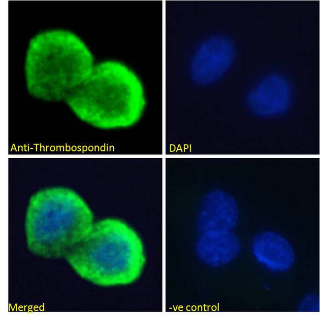 THBS1 / Thrombospondin-1 Antibody - THBS1 / Thrombospondin-1 antibody immunofluorescence analysis of paraformaldehyde fixed HepG2 cells, permeabilized with 0.15% Triton. Primary incubation 1hr (10ug/ml) followed by Alexa Fluor 488 secondary antibody (4ug/ml), showing cytoplasmic/Plasma Membrane staining. The nuclear stain is DAPI (blue). Negative control: Unimmunized goat IgG (10ug/ml) followed by Alexa Fluor 488 secondary antibody (4ug/ml).