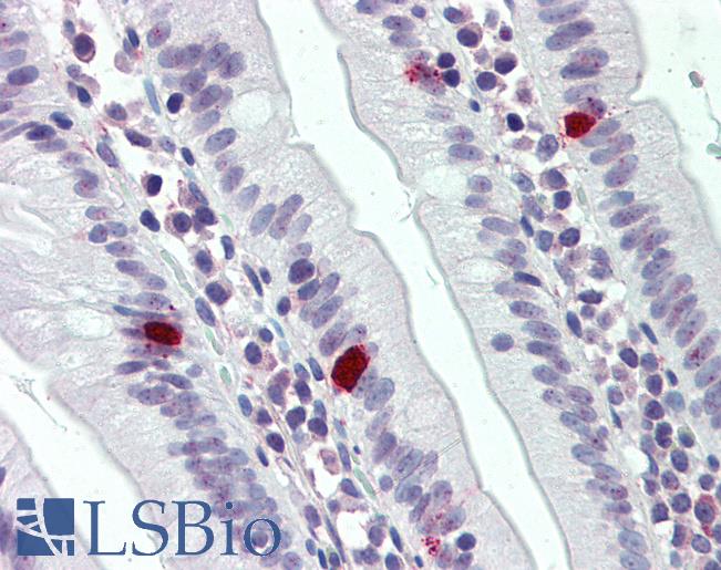 THEM6 / C8orf55 Antibody - Small intestine: Formalin-Fixed, Paraffin-Embedded (FFPE)