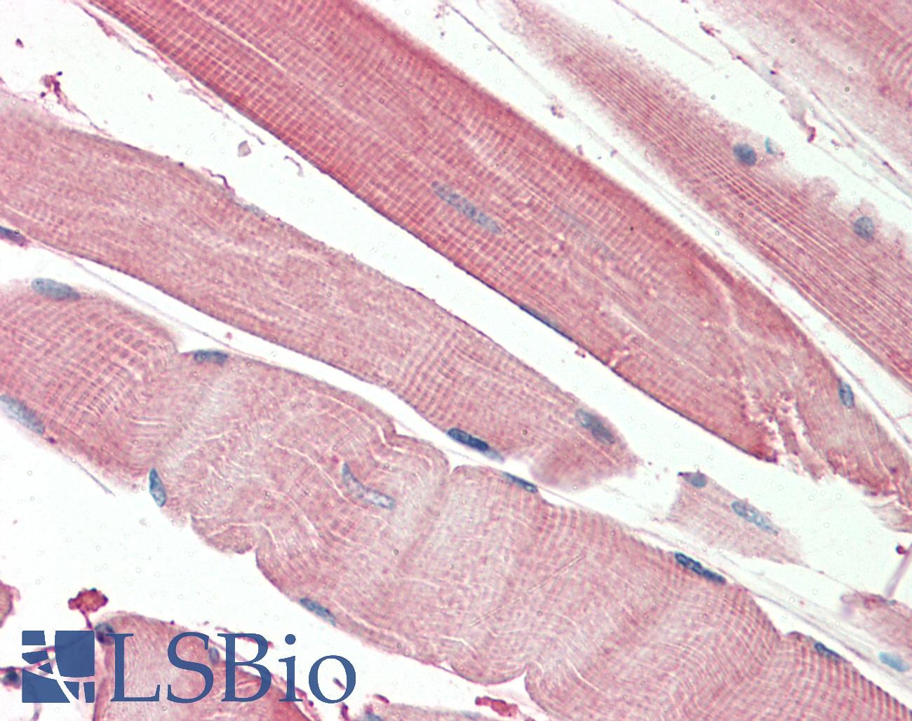THNSL2 Antibody - Anti-THNSL2 antibody IHC staining of human skeletal muscle. Immunohistochemistry of formalin-fixed, paraffin-embedded tissue after heat-induced antigen retrieval. Antibody concentration 5 ug/ml.
