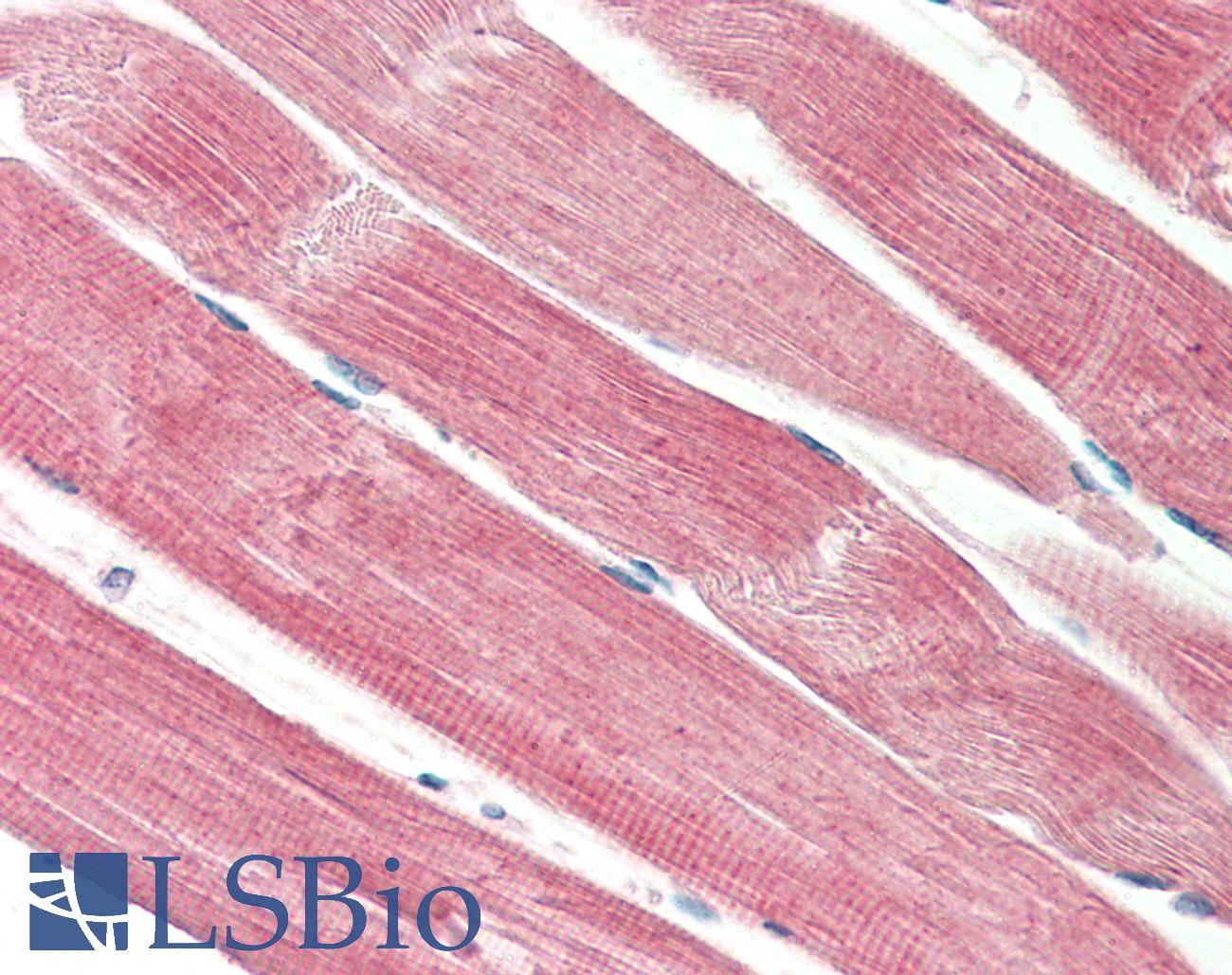 THNSL2 Antibody - Anti-THNSL2 antibody IHC staining of human skeletal muscle. Immunohistochemistry of formalin-fixed, paraffin-embedded tissue after heat-induced antigen retrieval. Antibody concentration 5 ug/ml.