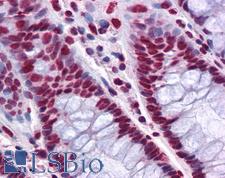 THOC6 Antibody - Anti-THOC6 / WDR58 antibody IHC of human colon. Immunohistochemistry of formalin-fixed, paraffin-embedded tissue after heat-induced antigen retrieval. Antibody concentration 5 ug/ml.