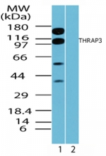 THRAP3 / TRAP150 Antibody - Western blot of human Thyroid hormone receptor associated protein 3 in HeLa cell lysate in the 1) absence and 2) presence of immunizing peptide using antibody at 0.1 ug/ml.