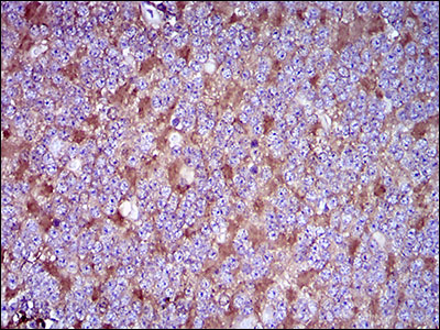 THY1 / CD90 Antibody - IHC of paraffin-embedded cerebellum tissues using THY1 mouse monoclonal antibody with DAB staining.