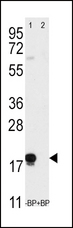 THY1 / CD90 Antibody - Western blot of anti-THY1 antibody pre-incubated without(lane 1) and with(lane 2) blocking peptide (BP2050a) in T47D cell line lysate. THY1 (arrow) was detected using the purified antibody.