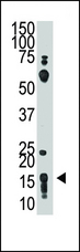 THY1 / CD90 Antibody - The anti-THY1 antibody is used in Western blot to detect THY1 in HL60 cell lysate.