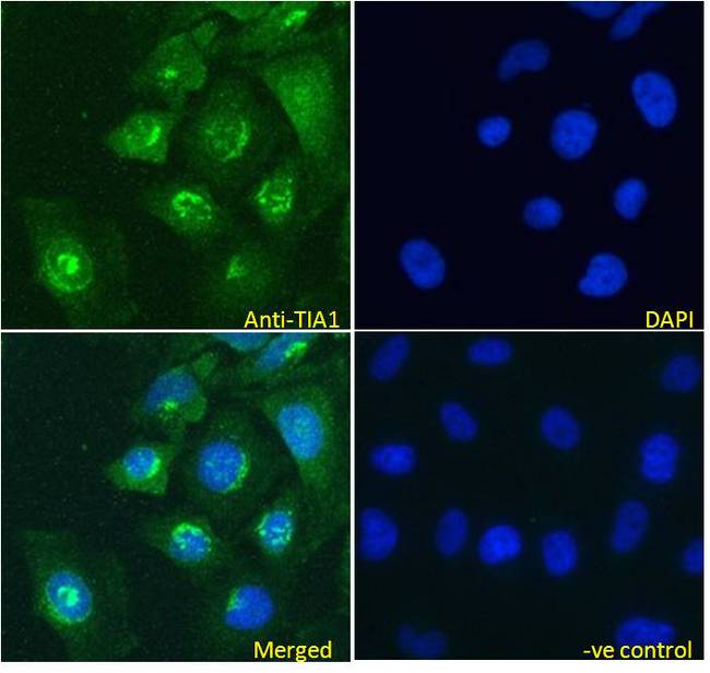 TIA-1 Antibody - TIA-1 antibody immunofluorescence analysis of paraformaldehyde fixed HeLa cells, permeabilized with 0.15% Triton. Primary incubation 1hr (5ug/ml) followed by Alexa Fluor 488 secondary antibody (2ug/ml), showing nuclear and some cytoplasmic staining. The nuclear stain is DAPI (blue). Negative control: Unimmunized goat IgG (10ug/ml) followed by Alexa Fluor 488 secondary antibody (4ug/ml).