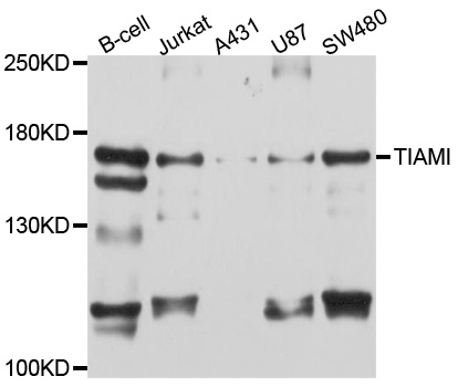TIAM1 Antibody - Western blot analysis of extracts of various cell lines, using TIAM1 antibody at 1:1000 dilution. The secondary antibody used was an HRP Goat Anti-Rabbit IgG (H+L) at 1:10000 dilution. Lysates were loaded 25ug per lane and 3% nonfat dry milk in TBST was used for blocking. An ECL Kit was used for detection and the exposure time was 30s.