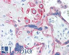 TIAM1 Antibody - Human Placenta: Formalin-Fixed, Paraffin-Embedded (FFPE)