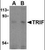 TICAM1 / TRIF Antibody - Western blot of TRIF in human lung cell lysates with TRIF antibody at (A) 2 and (B) 4 g/ml. 