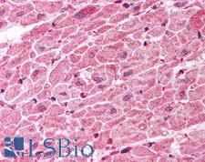 TICAM1 / TRIF Antibody - Anti-TICAM1 / TRIF antibody IHC of human heart. Immunohistochemistry of formalin-fixed, paraffin-embedded tissue after heat-induced antigen retrieval. Antibody concentration 10 ug/ml.