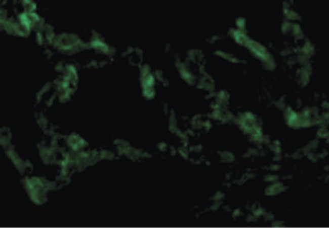 TICAM1 / TRIF Antibody - Immunofluorescence of TRIF in Human Lung cells with TRIF antibody at 10 ug/ml.