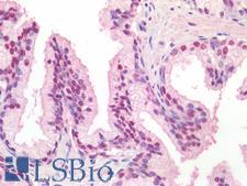 TICAM1 / TRIF Antibody - Human Prostate: Formalin-Fixed, Paraffin-Embedded (FFPE)