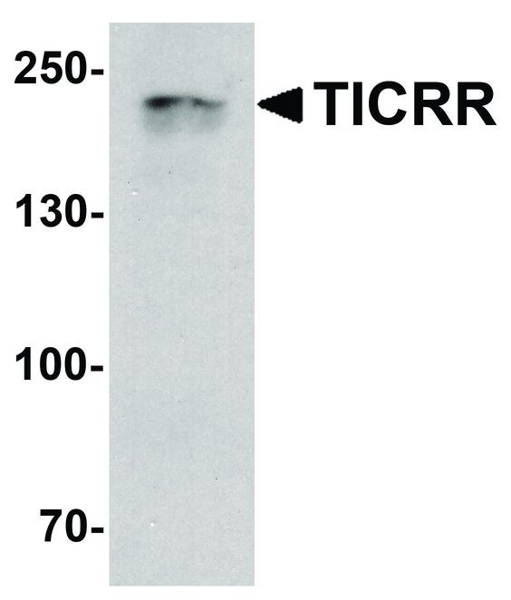 TICRR Antibody - Western blot analysis of TICRR in human small intestine tissue lysate with TICRR antibody at 1 ug/ml.