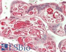 TIE1 / TIE Antibody - Human Placenta: Formalin-Fixed, Paraffin-Embedded (FFPE)