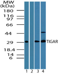 TIGAR Antibody - Western blot of human TIGAR in human liver in the 1) absence and 2) presence of immunizing peptide, 3) mouse liver and 4) rat liver lysate using antibody at 1, 4 and 2 ug/ml, respectively.