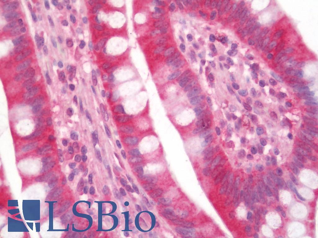 TIGAR Antibody - Human Small Intestine: Formalin-Fixed, Paraffin-Embedded (FFPE)