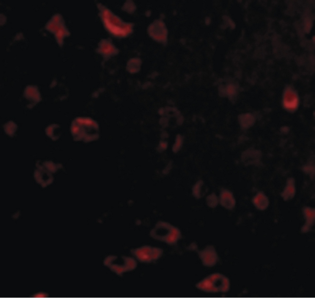 TIGAR Antibody - Immunofluorescence of TIGAR in Human Brain cells with TIGAR antibody at 20 ug/ml.