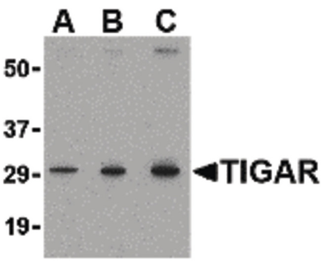 TIGAR Antibody - Western blot of TIGAR in MCF7 cell lysate with TIGAR antibody at (A) 0.5, (B) 1 and (C) 2 ug/ml.
