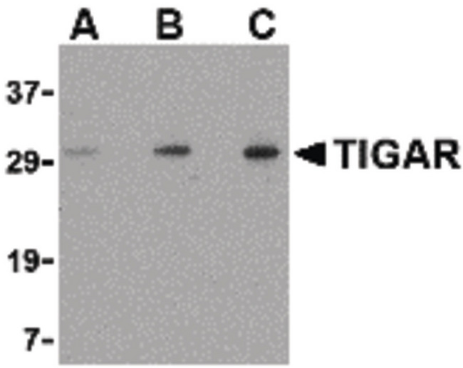 TIGAR Antibody - Western blot of TIGAR in EL4 cell lysate with TIGAR antibody at (A) 0.5, (B) 1 and (C) 2 ug/ml.