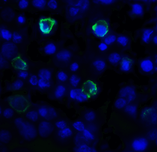 TIGIT Antibody - Immunofluorescence of TIGIT in over expressing HEK293 cells using TIGIT Antibody at 1 ug/ml. Green: TIGIT Antibody [3B5] Blue: DAPI staining