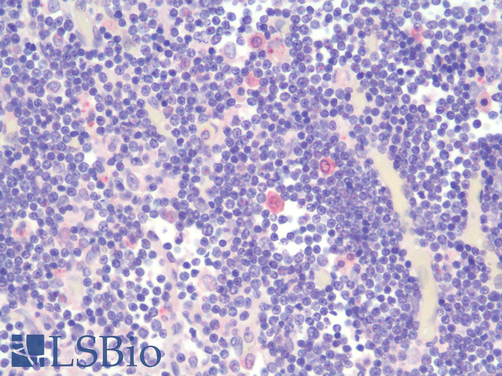 TIGIT Antibody - Human Thymus: Formalin-Fixed, Paraffin-Embedded (FFPE)