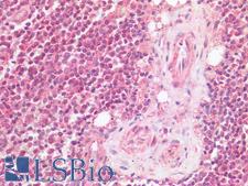 TIGIT Antibody - Human Spleen: Formalin-Fixed, Paraffin-Embedded (FFPE)