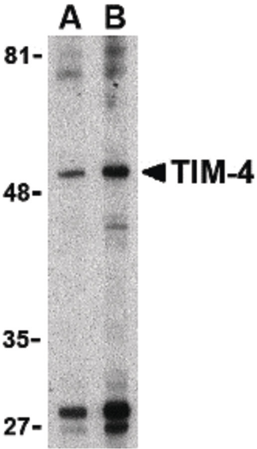TIMD4 / TIM4 / TIM-4 Antibody - Western blot of TIM-4 in Jurkat lysate with TIM-4 antibody at (A) 1 and (B) 2 ug/ml.