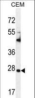 TIMP1 Antibody - TIMP1 Antibody western blot of CEM cell line lysates (35 ug/lane). The TIMP1 antibody detected the TIMP1 protein (arrow).