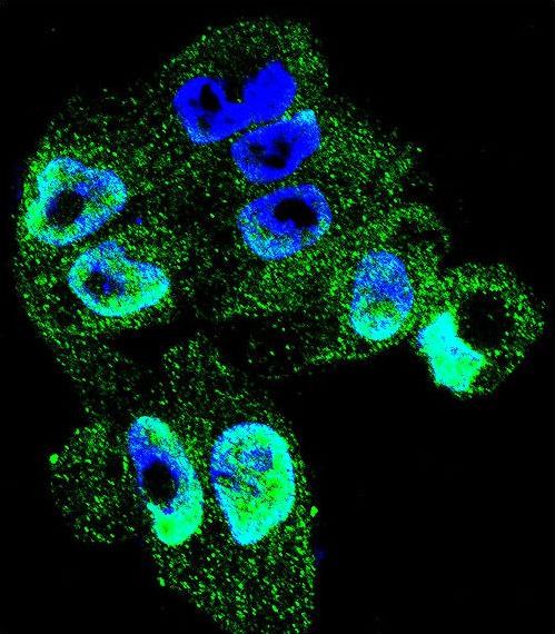 TIMP1 Antibody - Confocal immunofluorescence of TIMP1 Antibody with A2058 cell followed by Alexa Fluor 488-conjugated goat anti-rabbit lgG (green). DAPI was used to stain the cell nuclear (blue).