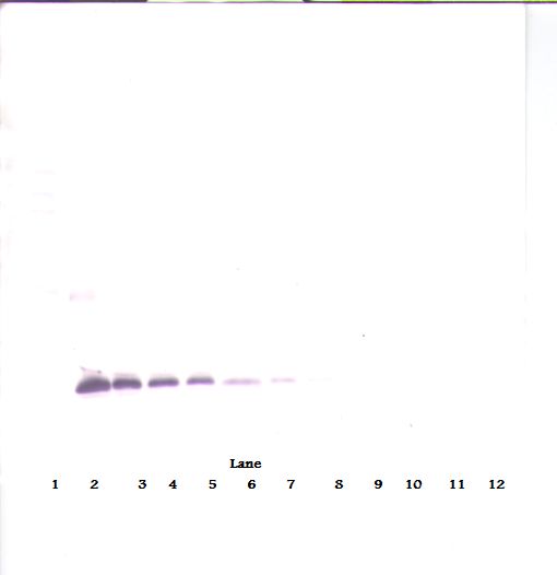 TIMP1 Antibody - Western Blot (non-reducing) of TIMP-1 antibody