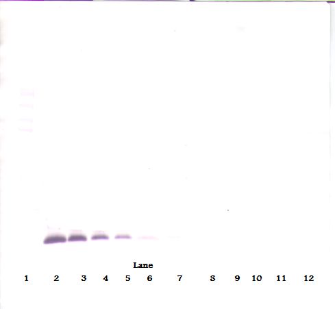 TIMP1 Antibody - Western Blot (reducing) of TIMP-1 antibody