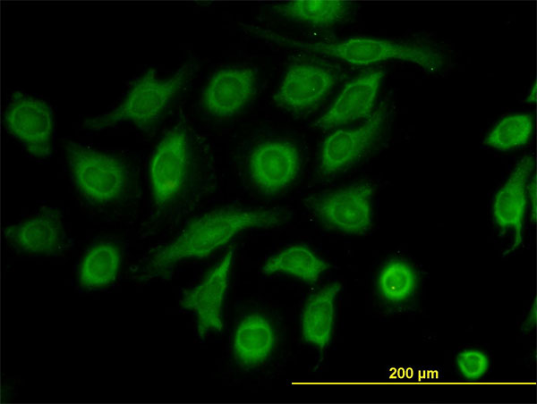 TIMP2 Antibody - Immunofluorescence of monoclonal antibody to TIMP2 on HeLa cell. [antibody concentration 10 ug/ml]