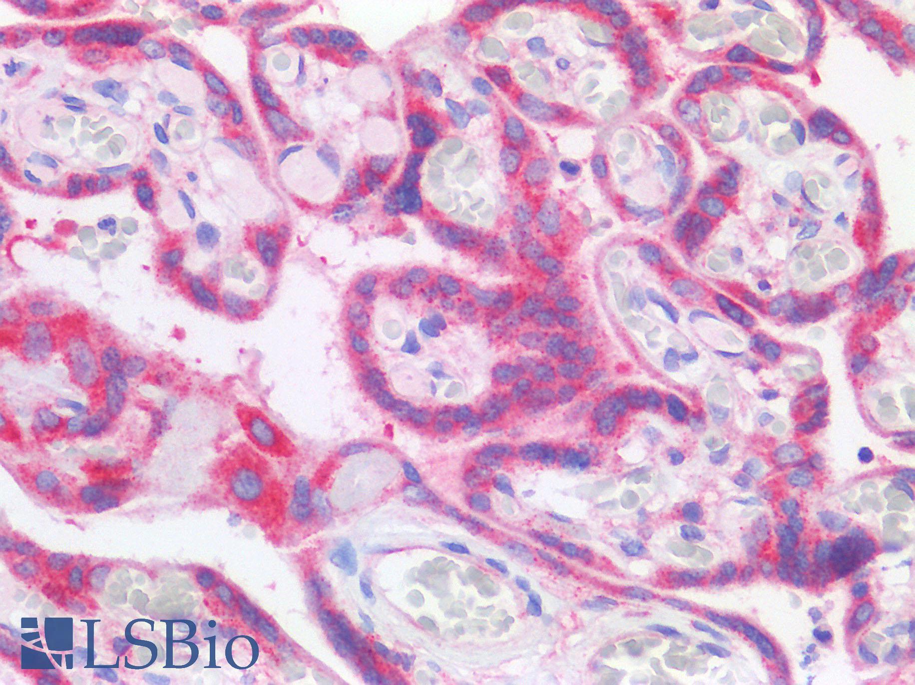 TIMP3 Antibody - Placenta: Formalin-Fixed, Paraffin-Embedded (FFPE)
